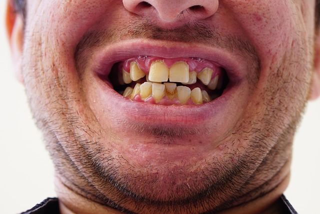 Usynlig og effektiv: Derfor vælger flere invisalign bøjle